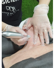 Neo Stimulation visage